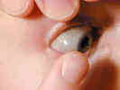 contactlens1247.jpg (439924 bytes)