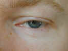 eye2308.jpg (749430 bytes)
