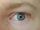 eye2309.jpg (727213 bytes)
