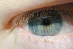 eye2312.jpg (393472 bytes)