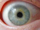 eye2316.jpg (450041 bytes)
