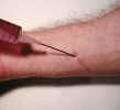 needleinjecting03250015.jpg (432030 bytes)