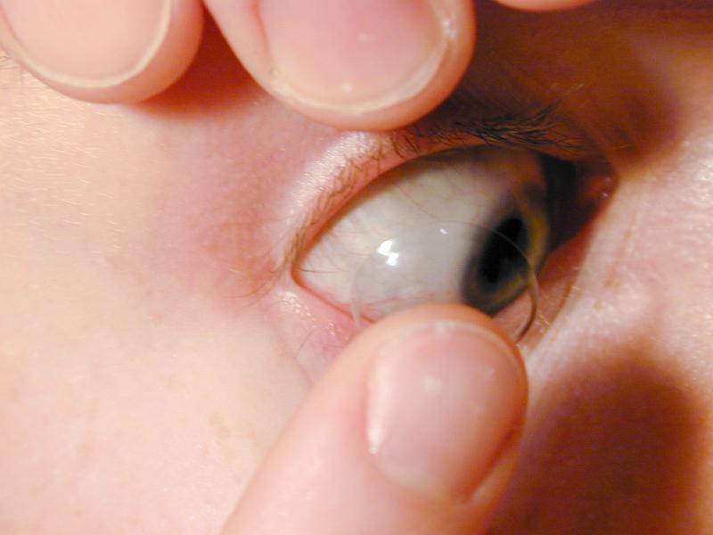 Free Stock Photo: Man showing off the contact lens in his eye holding back his eyelids with his fingers so the disposable lens is visible