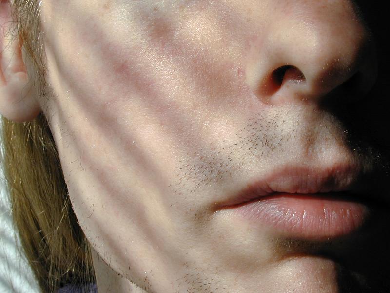 Free Stock Photo: Close up of the sullen glum mouth of a young man with an unshaven upper lip with bristle taken in dappled sunlight with line shadows - concept of mental health