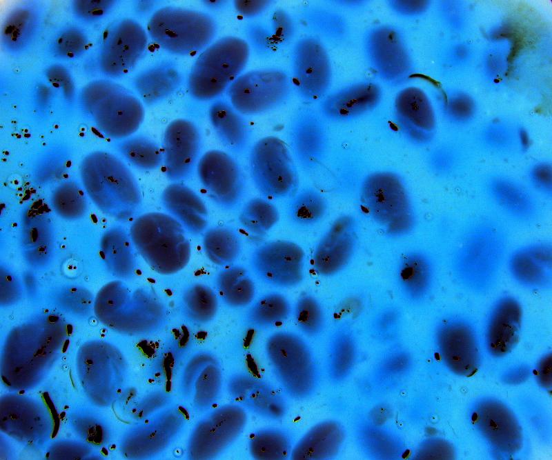 Free Stock Photo: Blue Abstract for Image Backgrounds, Medical Virus or Biological Speciman on Slide Viewed Through Microscrope
